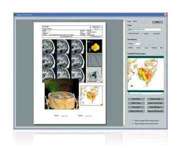 Planning software / for radiosurgery / medical Aimrad Micromar