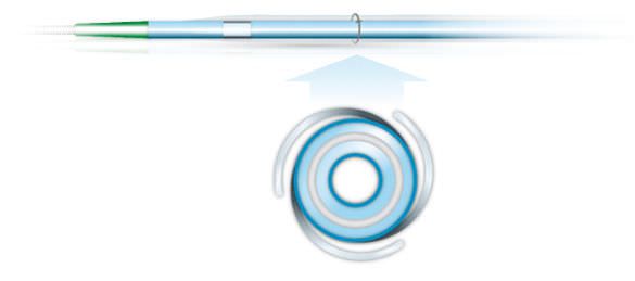 Dilatation catheter / coronary / balloon 4.5 - 5 mm | Sapphire NC OrbusNeich