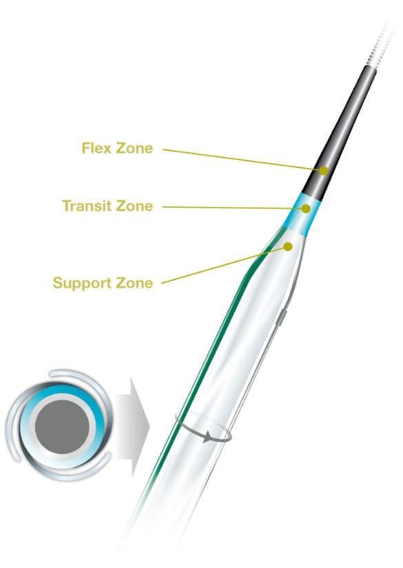 Dilatation catheter / coronary / balloon 2 - 4 mm | Scoreflex OrbusNeich