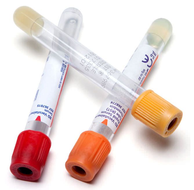 Collection tube BD Vacutainer® BD