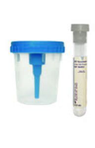 Urine sample container BD