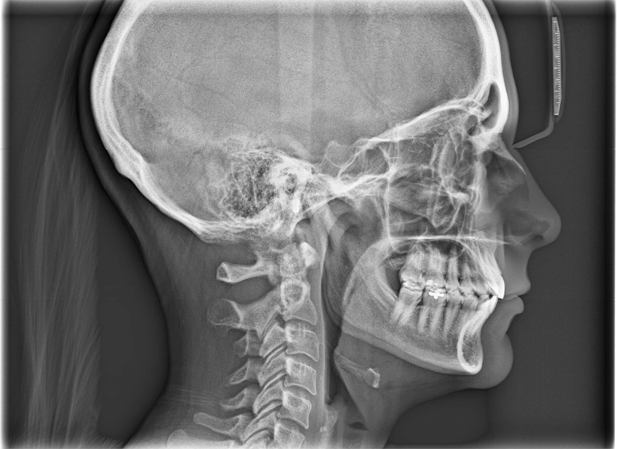 Cephalometric X-ray system (dental radiology) / panoramic X-ray system / digital Progeny Vantage® C MIDMARK