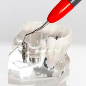 Dental curette / implant LM 283-284MTi EM LM-INSTRUMENTS OY